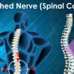 A Pinched Nerve Feel