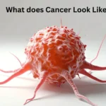 Cancer Look Like