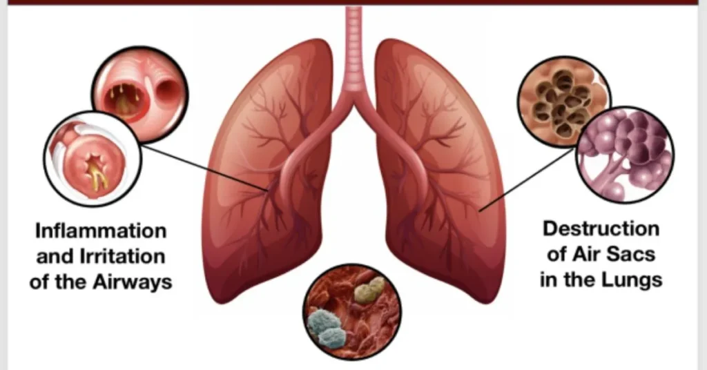 Vaping Do to Your Lungs