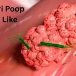 H Pylori Poop Look Like